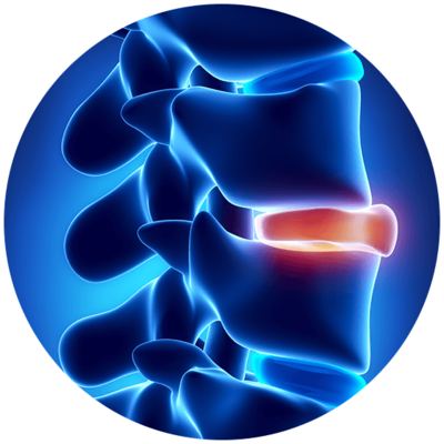 low back pain overland park ks