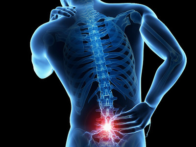 low back pain overland park ks